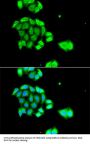 Rad51D Antibody