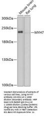 MYH7 Antibody