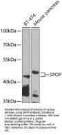 SPOP Antibody