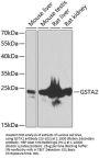 GSTA2 Antibody