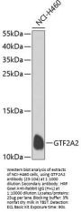 GTF2A2 Antibody