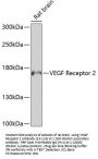 VEGF Receptor 2 Antibody