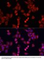 SMAD2 Antibody, KO Validated
