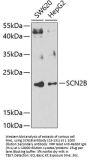 SCN2B Antibody