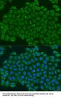 TNNC2 Antibody