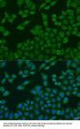 PLA2G4C Antibody