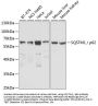 SQSTM1 / p62 Antibody