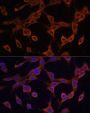 SQSTM1 / p62 Antibody