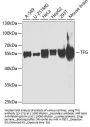 TFG Antibody