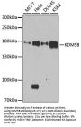 KDM5B Antibody