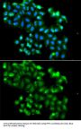 PHF11 Antibody