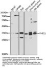 PHF11 Antibody