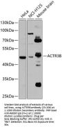 ACTR3B Antibody