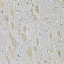 RAB17 Antibody