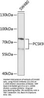 PCSK9 Antibody