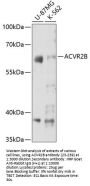 ACVR2B Antibody
