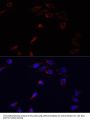 ADRA1B Antibody