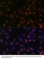 ITPR1 Antibody