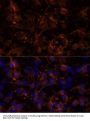 NCAM1 / CD56 Antibody