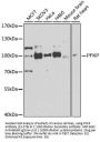 PFKP Antibody, KO Validated