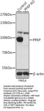 PFKP Antibody, KO Validated