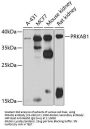 PRKAB1 Antibody
