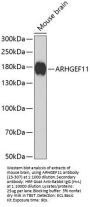 ARHGEF11 Antibody