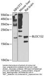 BLOC1S2 Antibody
