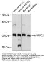 ANAPC2 Antibody