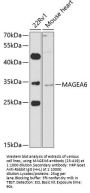 MAGEA6 Antibody