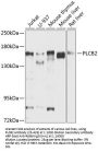PLCB2 Antibody