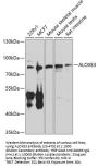 ALOXE3 Antibody