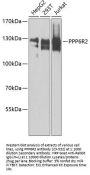 PPP6R2 Antibody