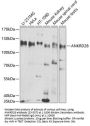 ANKRD28 Antibody