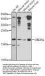 UBE2NL Antibody