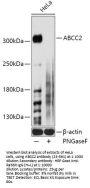 ABCC2 Antibody