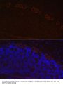 NEFH Antibody