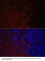NEFH Antibody