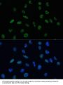 MKL1 Antibody