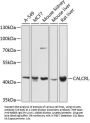 CALCRL Antibody