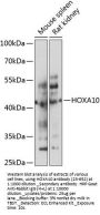 HOXA10 Antibody