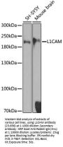 L1CAM Antibody, KO Validated