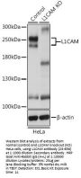 L1CAM Antibody, KO Validated