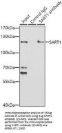SART1 Antibody