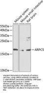 ARPC5 Antibody