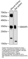 GIMAP5 Antibody