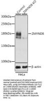 ZMYND8 Antibody, KO Validated