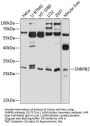 SNRPB2 Antibody