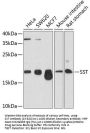 SST Antibody