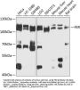 FER Antibody
